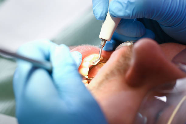 Best Emergency Dental Services for Seniors in Ford City, CA